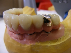 Denture