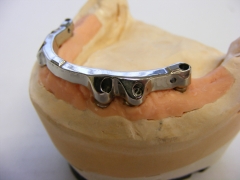 Implant milled bar